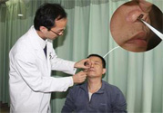 鼻咽癌的發(fā)病因素是什么？鼻咽癌的并發(fā)癥有哪些？