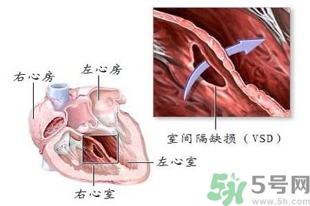 心臟病是怎么形成的？易發(fā)人群有哪些？