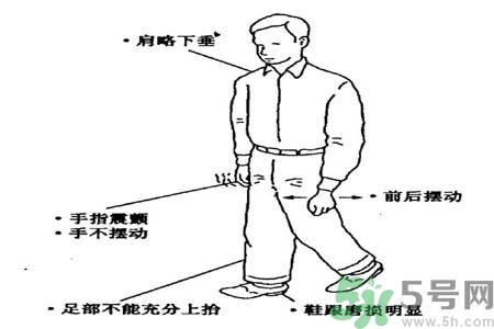 帕金森要注意哪些措施？帕金森的飲食需注意什么？