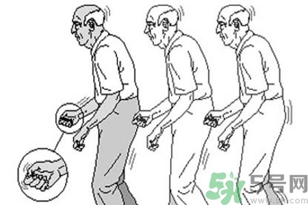 帕金森要注意哪些措施？帕金森的飲食需注意什么？