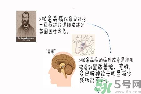 帕金森的治療方法有哪些？