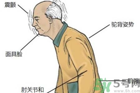 帕金森的易發(fā)人群有哪些？如何預(yù)防帕金森？