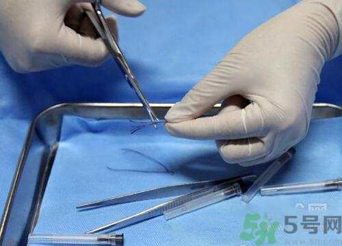 埋線減肥多少錢一次？埋線減肥的副作用