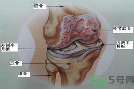 預防骨病需要注意哪些姿勢？秋季預防骨病的方法有哪些？