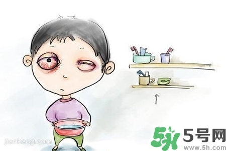 寶寶為什么會(huì)感染紅眼??？寶寶患紅眼病如何治療？