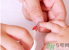 寶寶長(zhǎng)蘚是怎么回事？寶寶長(zhǎng)蘚怎么辦？