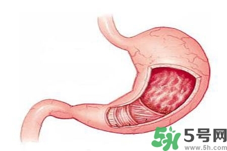 急性腸胃炎哪些食物不可以吃？急性腸胃炎不能吃的水果有？