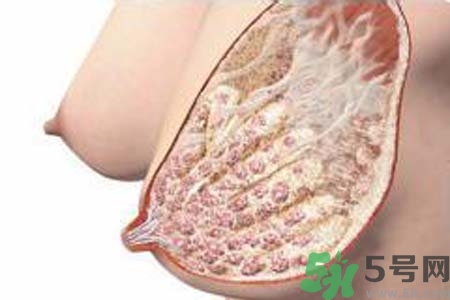 乳腺增生治療方法是什么？乳腺增生的檢查方法有哪些？