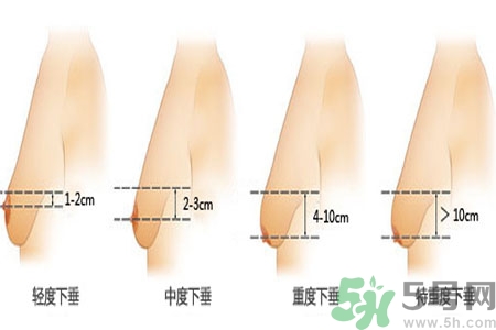 胸部松弛的原因是什么？胸部松弛該怎么辦？