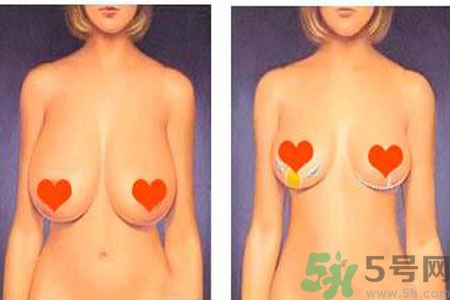 如何預(yù)防胸部松弛？吃什么能使胸部挺拔？