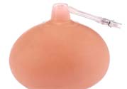 乳頭內(nèi)陷可以拔罐嗎？乳頭內(nèi)陷需要手術(shù)治療嗎？