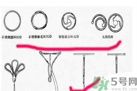 避孕的辦法有什么？避孕的方法有哪些？