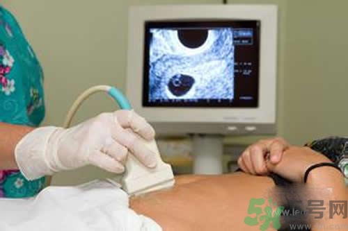 孕婦做b超要空腹嗎？孕婦做b超要不要空腹？