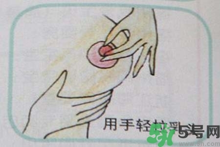乳頭內(nèi)陷怎么矯正？乳頭內(nèi)陷矯正方法是什么？