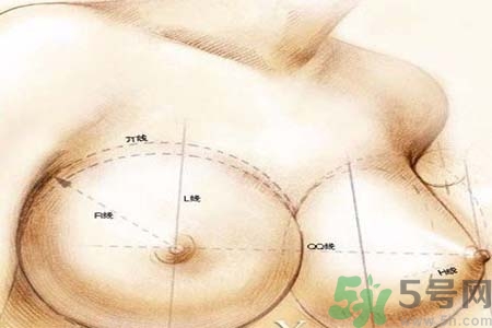 乳頭內(nèi)陷可以用吸奶器嗎？乳頭內(nèi)陷能不能用吸奶器？