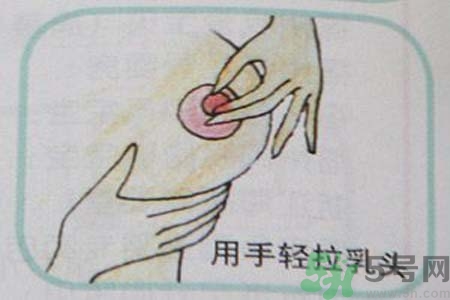 乳頭內(nèi)陷可以拔罐嗎？乳頭內(nèi)陷需要手術(shù)治療嗎？