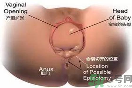 女性陰道松弛的原因是什么？女性陰道松弛怎么辦？