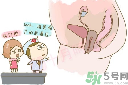 陰道松弛是什么？陰道松弛的癥狀有哪些？