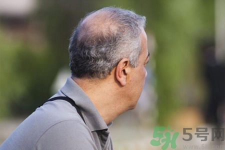 男性衰老的征兆有哪些？男性10個(gè)難以逆轉(zhuǎn)的衰老征兆