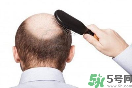男性防止性衰老決竅有哪些？男性受用一生抵抗衰老法則
