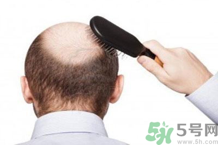結(jié)構(gòu)性中年危機(jī)是什么？男性一生的10個(gè)年齡坎