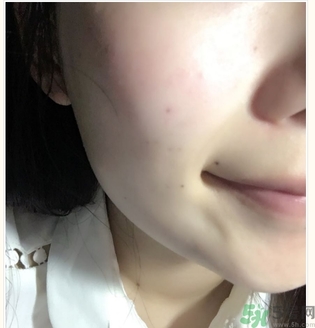 麗得姿面膜適合孕婦可以用嗎？麗得姿面膜哪些孕婦可以用？