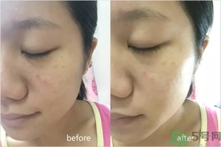 rilastil面膜使用方法 維納斯蒂爾面膜怎么用？
