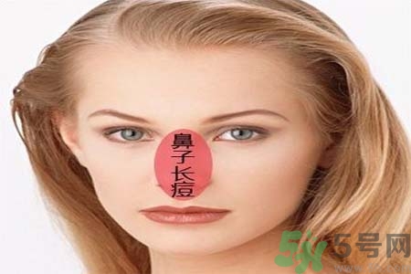 鼻翼長痘痘怎么辦？鼻翼長痘解決方法有哪些？