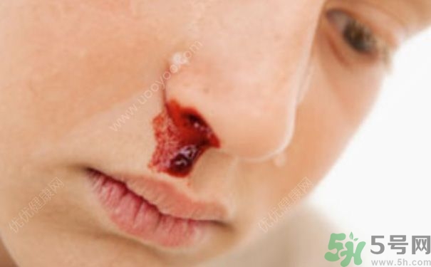 15歲男孩可以刮胡子嗎？15歲男孩經(jīng)常流鼻血怎么回事？