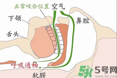鼻子紅是什么原因？鼻子紅怎么辦？