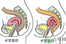 ?子宮移位怎么治療？子宮移位能懷孕嗎？