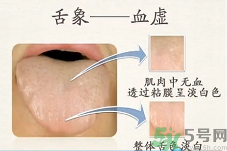 血虛怎么調(diào)理？女人血虛怎么調(diào)理？
