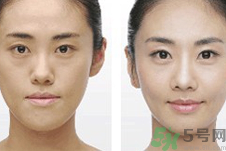 激光縮毛孔多少錢一次？激光縮毛孔一個療程多少錢？