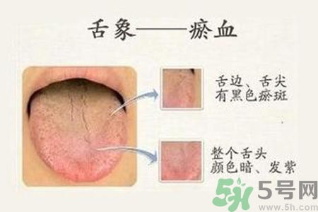 血瘀體質(zhì)吃什么？血瘀體質(zhì)怎么調(diào)理？
