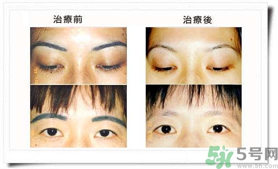 紋眉毛有什么危害？紋眉后注意事項