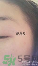 dr.jart適合什么年齡層？蒂佳婷適合年齡