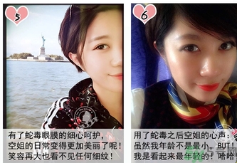 蛇毒眼膜孕婦可以用嗎？ 日本spa蛇毒眼膜孕婦能用嗎？