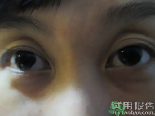 蛇毒眼膜效果怎么樣？spa蛇毒眼膜紅色好用嗎？