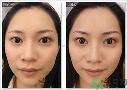 眉毛怎么整形好看？眉毛怎么整自然？
