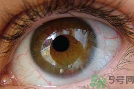 ?干眼癥的治療方法是什么？如何預(yù)防干眼癥？