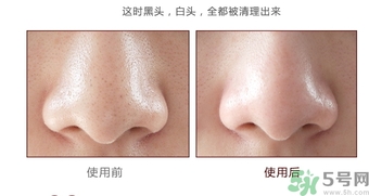 yu.r巧克力棒鼻貼怎么樣？yu.r巧克力鼻貼好用嗎？