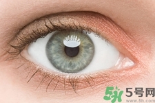 黑眼圈是怎么形成的？黑眼圈是什么原因引起的？
