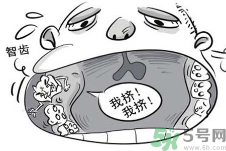 智齒拔了好不好？智齒能不拔嗎？