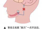 長(zhǎng)智齒疼痛怎么辦？長(zhǎng)智齒牙齦腫了怎么辦？