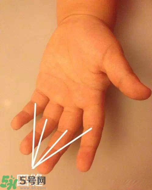 積食發(fā)燒怎么推拿？積食發(fā)燒推拿手法圖解
