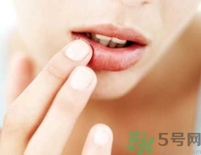 孕婦嘴唇干裂脫皮怎么回事？孕婦嘴唇干裂脫皮是缺什么