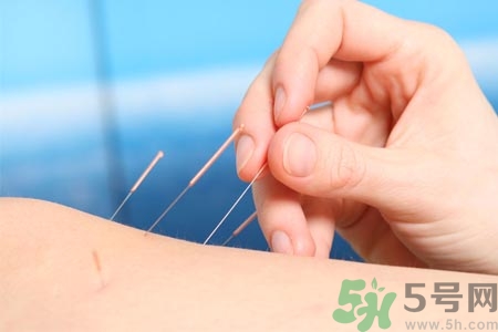 針灸一次要扎多長(zhǎng)時(shí)間？針灸可以幾天做一次？