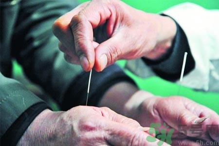 針灸一次要扎多長(zhǎng)時(shí)間？針灸可以幾天做一次？