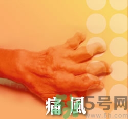 骨關(guān)節(jié)炎能治好嗎？骨關(guān)節(jié)炎平時注意事項