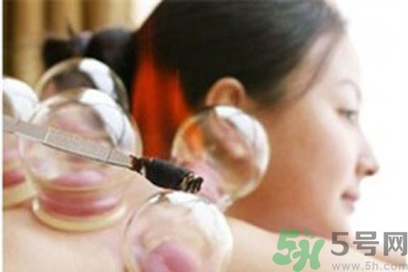 肩膀酸痛可以拔火罐嗎？孕婦肩膀酸痛能拔火罐嗎？